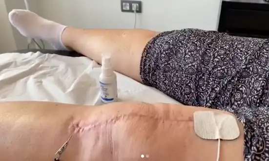Tratamiento de fisioterapia realizado por José en Health & Motion